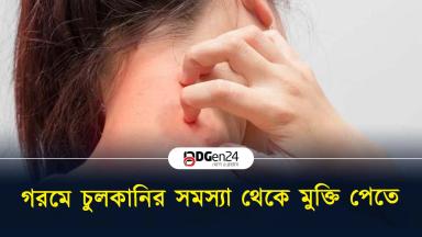 গরমে চুলকানির সমস্যা থেকে মুক্তি পেতে